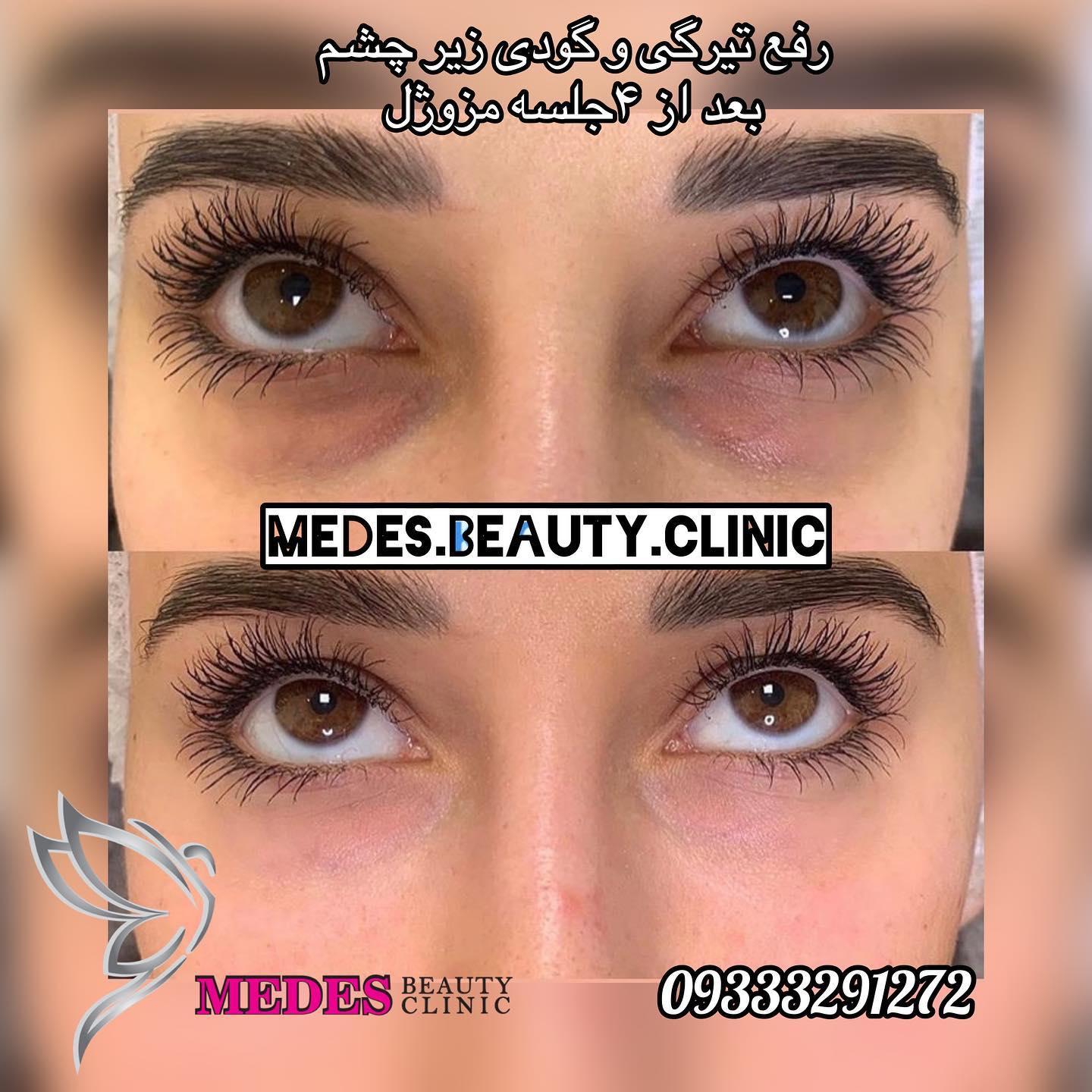 گالری مزوژل